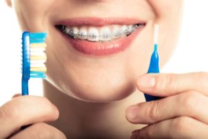 ارتودنسی - بهداشت دهان و دندان